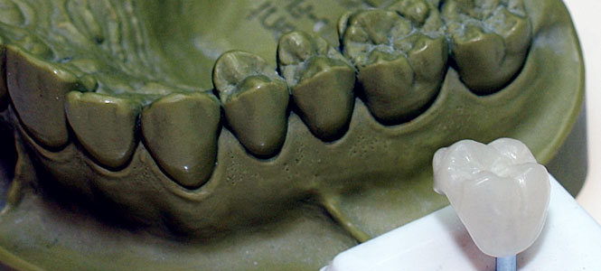 provvisori prelimatura