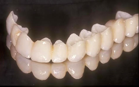 zirconia monolitico